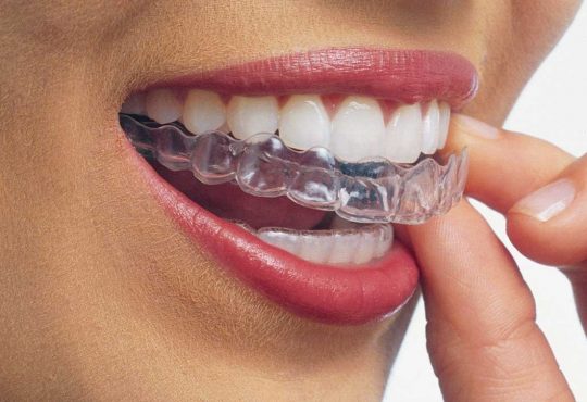Invisalign com especialista certificada